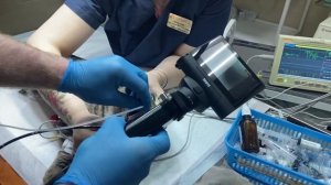 Трахеобронхоскопия и бронхоальвеолярный лаваж.