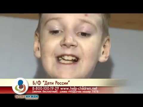 Рома Бордаков — мальчик с хрупкой кожей смотреть онлайн
