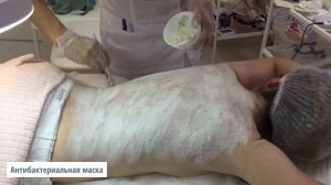 Чистка спины