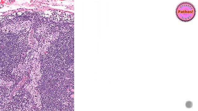Approach To Lymph Node Pathology- Part 1 смотреть онлайн