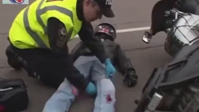 Правила наложения жгута для остановки артериального кровотечения смотреть онлайн