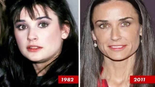 What Happened to Demi Moores Face ( Jan 2021) Is It A Plastic Surgery? Know More! смотреть онлайн