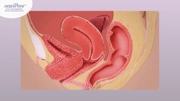 НоваРинг - механизм действия