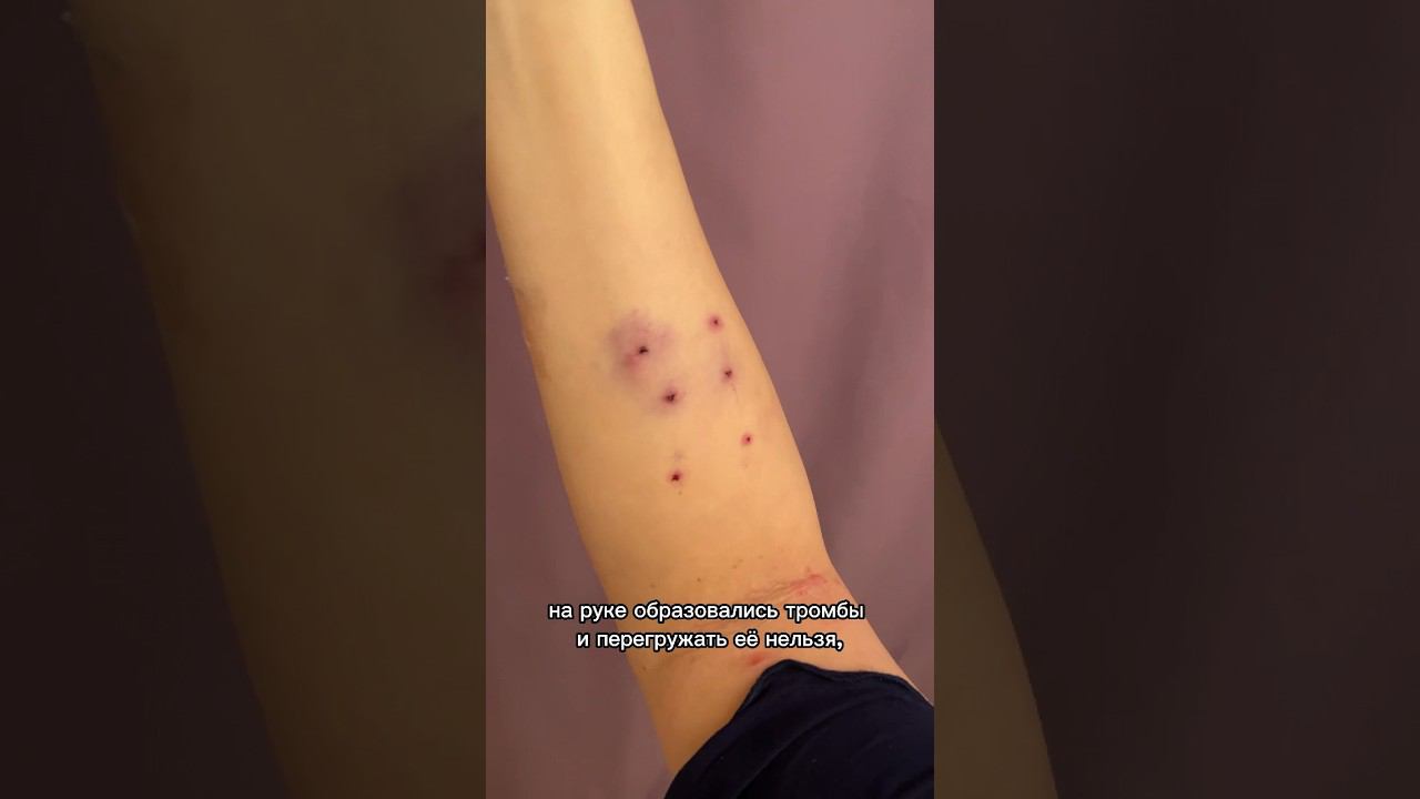 Осложнения после родов, что мне помогает