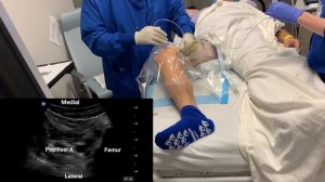 iPACK Block : How I do it. @Blockswami Sanjay Sinha