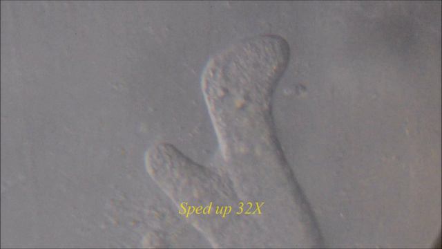 The Blob!-Amoeba Proteus Under The Microscope