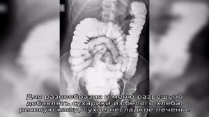 Особенности подготовки к ирригоскопии