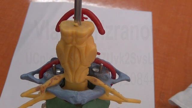 Ромбовидная ямка.  Модель ствола мозга с сосудами и позвоночником. Лекция для студентов