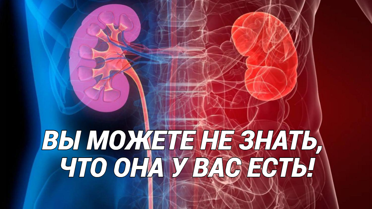 ХРОНИЧЕСКАЯ БОЛЕЗНЬ ПОЧЕК: что делать? смотреть онлайн