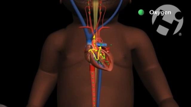 Кровообращение у плода
