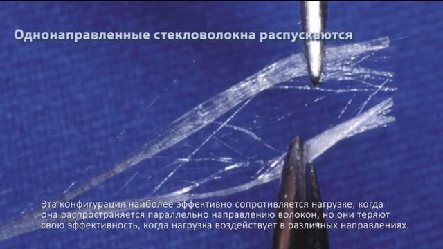 Сравнение волокон Ribbond с другими материалами для шинирования смотреть онлайн