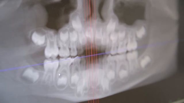 Зачем лечить молочные зубы? Рассказывает Алися Загребельная, главный врач, детский стоматолог смотреть онлайн