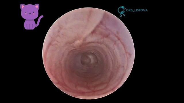 Feline Aspiration Pneumonia/Аспирационная пневмония у кошки