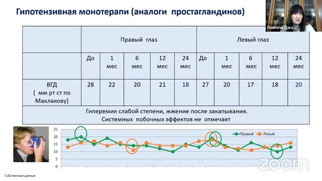Снижение зрения. Всегда ли виновата глаукома? смотреть онлайн