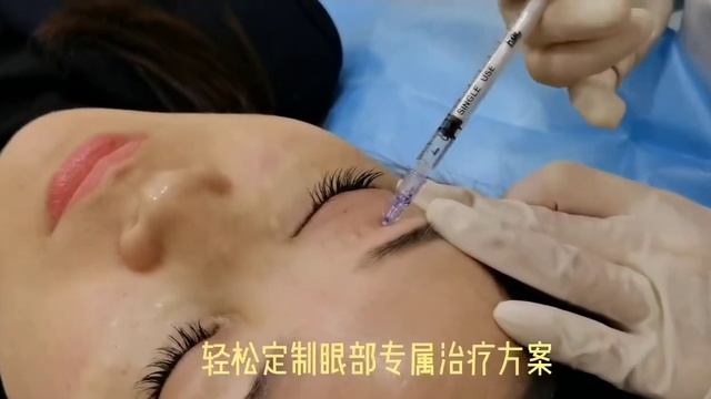 Контурная пластика лица. Микронидлинг смотреть онлайн