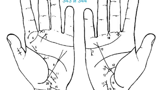 18. Д.Н. Стояновский. Диагностика заболеваний по кожным рисункам ладони смотреть онлайн