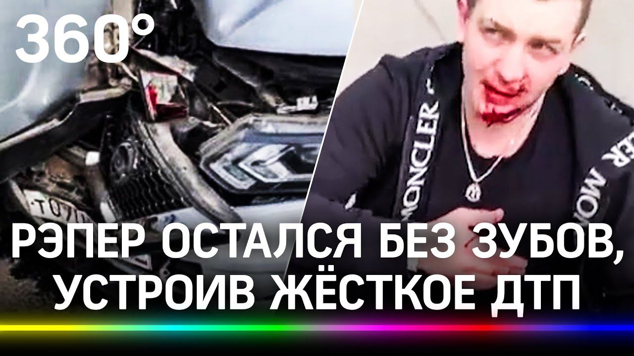 Видео: рэпер Yung Trappa остался без зубов после ДТП в Петербурге смотреть онлайн