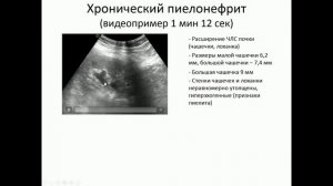 ЭХОСТРУКТУРНЫЕ ИЗМЕНЕНИЯ ПОЧЕК. Часть 1.