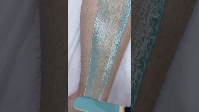 Полимерный воск в Epil Story🤍#депиляция #лазернаяэпиляция #электроэпиляция #косметология смотреть онлайн