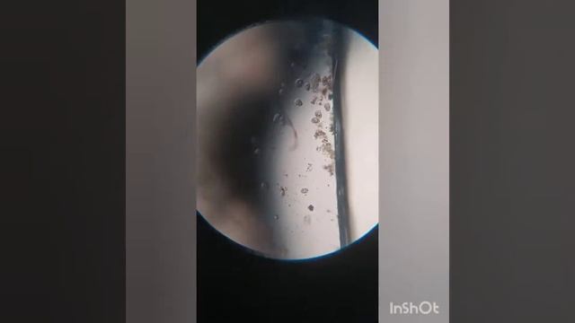 Вода из лужи под микроскопом видно бактерии и червяка которые там обитают# бактерии #микроскоп смотреть онлайн