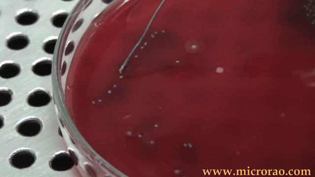 Bile solubility test смотреть онлайн