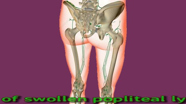 Swollen Popliteal Lymph Nodes Behind Knee: Causes And Treatment смотреть онлайн
