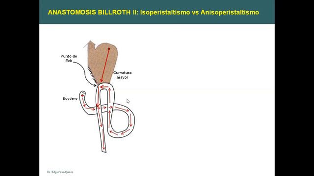 2.3. Cáncer Gastrico смотреть онлайн