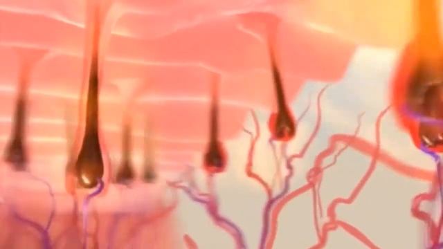 Какой лазер выбрать? смотреть онлайн