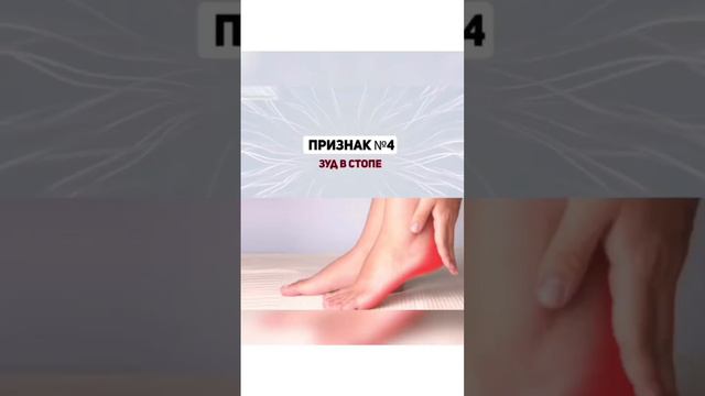 Что скажу ваши ноги о вашей печени? смотреть онлайн