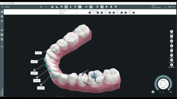 Программа Vision