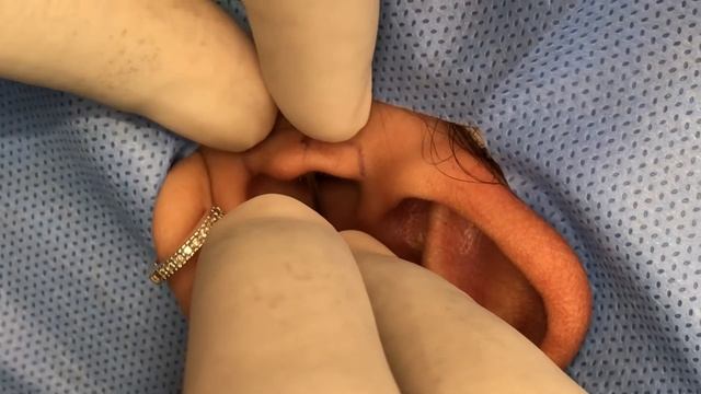 PIERCING NO TRÁGUS DOI? смотреть онлайн