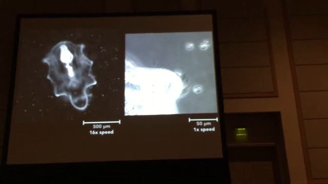 Feeding and swimming by starfish larvae. William Gilpin, APS DFD 2016. смотреть онлайн