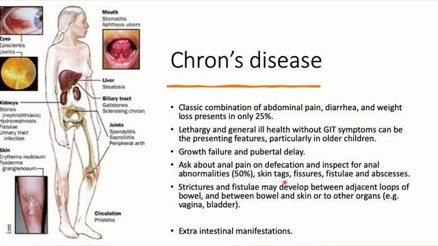 MRCPCH Fundamentals Course. Pediatric GIT 5 смотреть онлайн