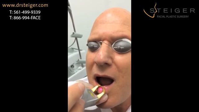 Laser of a Venous Lake on the Lip | Excel V смотреть онлайн