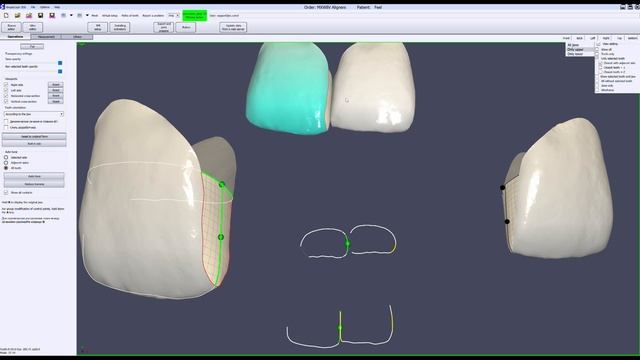 Simplyceph 3DS Teeth splitting functionality смотреть онлайн