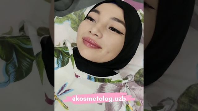LAB UCHUN FILLER /ФИЛЛЕР ДЛЯ ГУБ / LIP FILLER #ozbekiston #toshkent #filler #филлер #kosmetolog #la смотреть онлайн