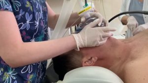 ИНТУБАЦИЯ ТРАХЕИ.