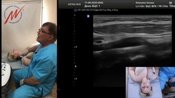 Стандарт УЗИ экстракраниальных БЦС (профессор Куликов В.П.)