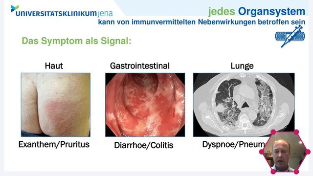 Krebsmedizin Aktuell: Immunonkologie смотреть онлайн