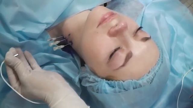 Лечение позвоночника. Шея. Радиочастотная нейромодуляция. смотреть онлайн