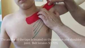 TAPING THE PECTORALIS MAJOR MUSCLE / Тейпирование большой грудной мышцы