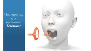 Позиционеры рентгенографических пластин