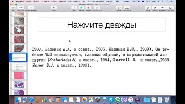 20 02 2018 Вэбинар Лиопласт Часть 2 Эпизод 2 смотреть онлайн