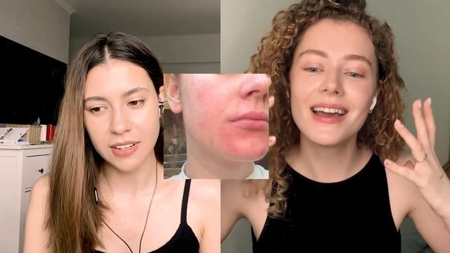 Акнекутан // как вылечить АКНЕ