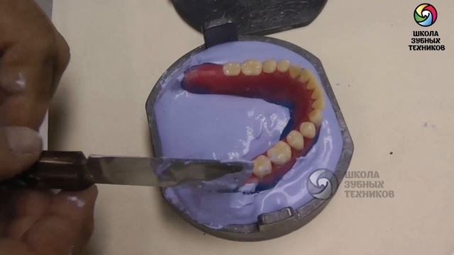 (ПСП 9) Лабораторный этап: Паковка в кювету для полимеризации смотреть онлайн