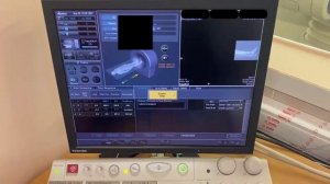 Компьютерная томография сосудов нижних конечностей с внутривенным болюсным контрастированием