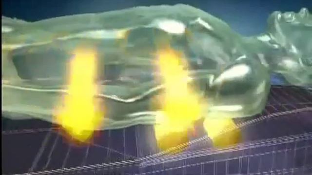 Působení vnitřního projektrou (NM-5000P) na páteř смотреть онлайн