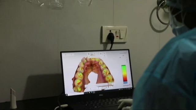 Digital impression with Intra Oral Scanner. смотреть онлайн