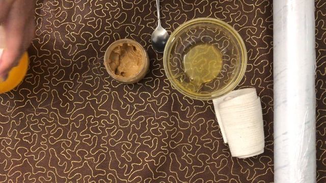 КАК ВЫЛЕЧИТЬ БОЛЬ В КОЛЕНЕ / ПРОСТОЙ И ДЕЙСТВЕННЫЙ РЕЦЕПТ ОТ БАБУШЕК!!!#здоровье#как вылечить колен смотреть онлайн