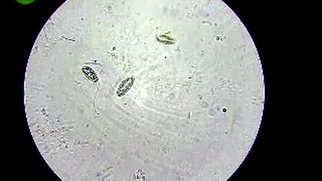 Протисты (Protista) смотреть онлайн